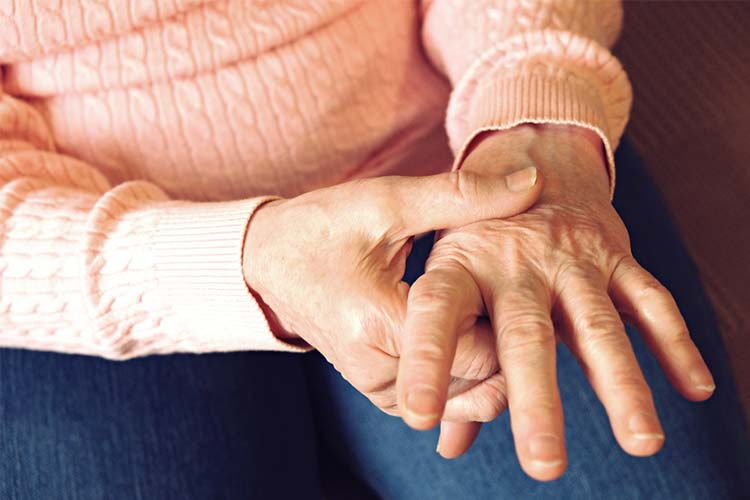 リウマチ科・膠原病画像